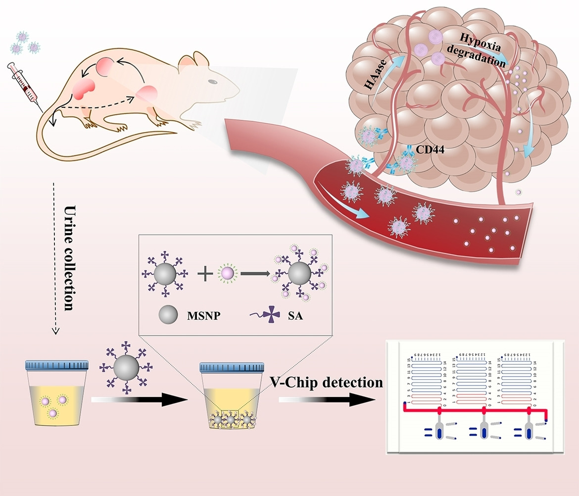 Hypoxia-Responsive Platinum Supernanoparticles for Urinary Microfluidic Monitoring of Tumors