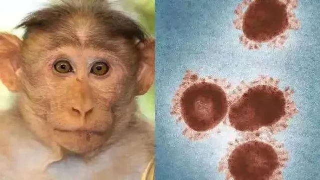 Several Chinese IVD companies have already developed monkeypox detection reagents!