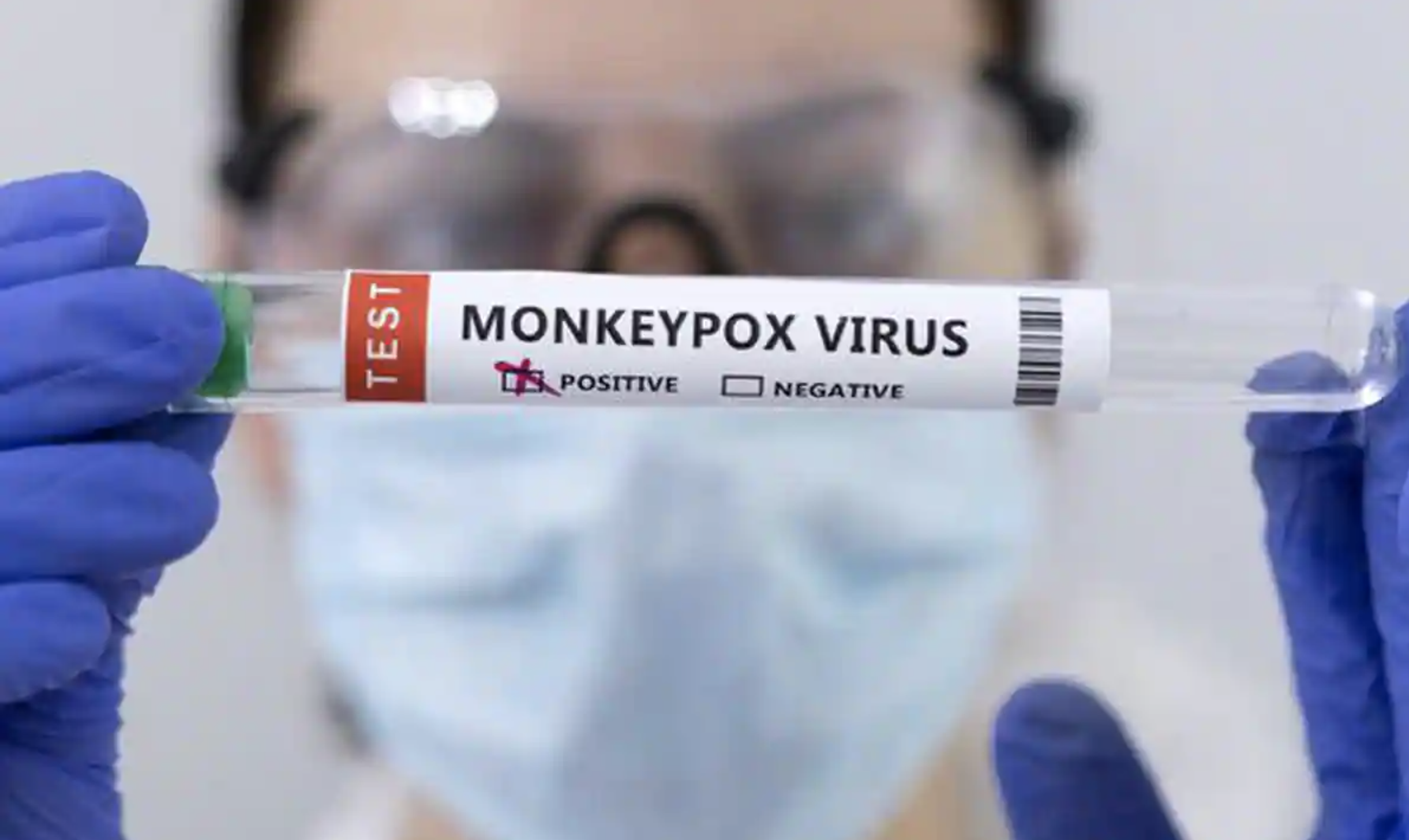 Over 40 Chinese IVD companies granted CE for monkeypox virus nucleic acid detection kits